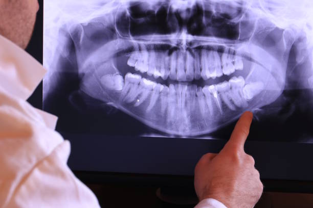Best Cosmetic Emergency Dentistry in Massanutten, VA