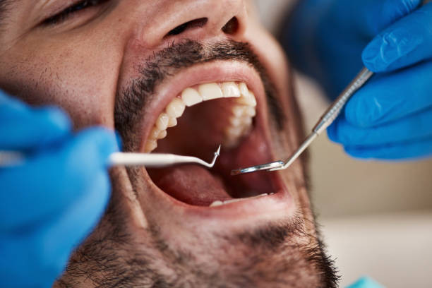 Best Emergency Dental Care for Broken or Chipped Teeth in Massanutten, VA